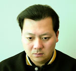 自毛植毛手術後体験者画像2