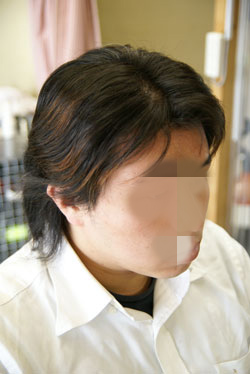 仙台市ホワイトブリーチ&赤・青のヘアカラー