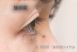 施術前画像｜まつげパーマ｜仙台市太白区 美容室ロイヤル