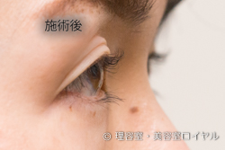 施術後画像｜まつげパーマ｜仙台市太白区 美容室ロイヤル
